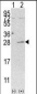 AK3 Antibody (C-term H38)